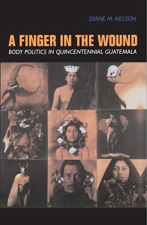 A Finger in the Wound